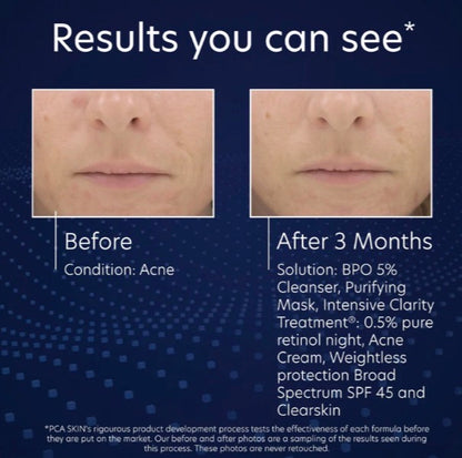 BPO 5% Cleanser