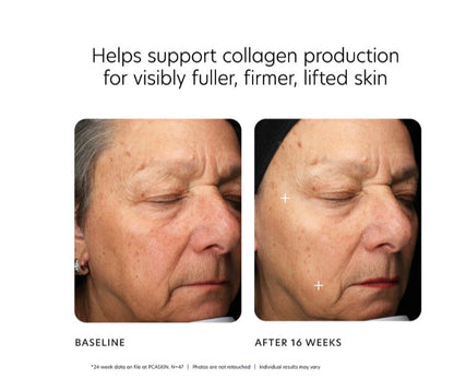 MGF Age Renewal Cream