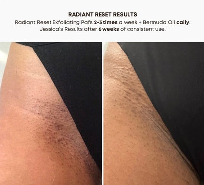 Radiant Reset Exfoliating Toner Pads